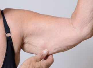 5 Grandes Remedios Hechos por Usted Mismo para la Flacidez de la Piel