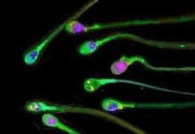 El recuento de espermatozoides continúa su caída en picado en el mundo occidental