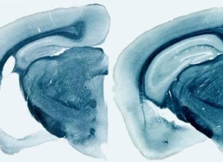 Reducir los niveles de proteína ApoE es la clave para prevenir o detener el alzhéimer