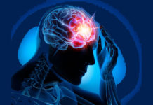 1,7% de los venezolanos convive a diario con la epilepsia