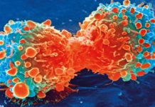 ¡Adiós quimioterapia! Españoles desarrollan generador que destruye tumores