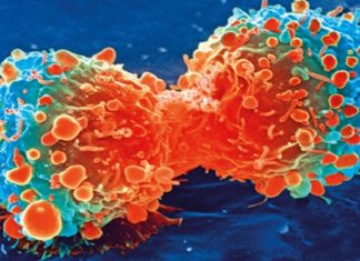 ¡Adiós quimioterapia! Españoles desarrollan generador que destruye tumores