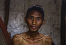 El paludismo y la desnutrición mantienen la población de waraos al borde de la muerte