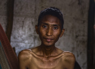 El paludismo y la desnutrición mantienen la población de waraos al borde de la muerte