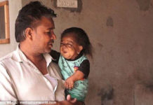 ¡Increíble! Tiene 23 años y está atrapado en el cuerpo de un bebé (+historia)