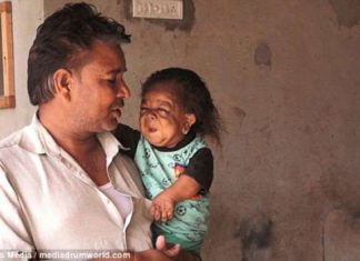 ¡Increíble! Tiene 23 años y está atrapado en el cuerpo de un bebé (+historia)